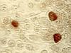 Chlamydia