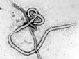 Objawy Eboli