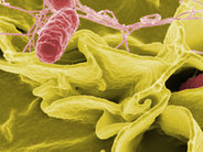 Salmonella: z fermy na widelec…