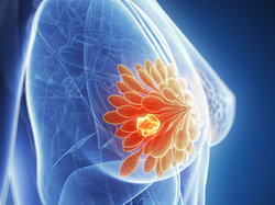 Mammografia nadal najlepszym sposobem wykrywania raka piersi