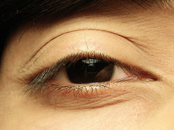 Pielęgnacja skóry wokół oczu