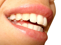 Prawdy i mity na temat wybielania zębów