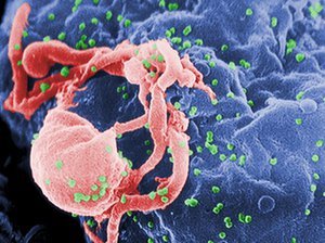 Wirus HIV pączkujący z hodowanego limfocytu.