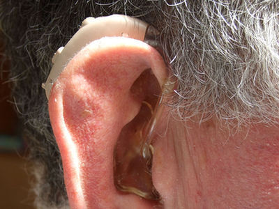 Dofinansowanie zakupu aparatu słuchowego: jest czy go nie ma?