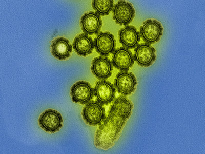 Świńska grypa w Polsce: Są przypadki śmiertelne