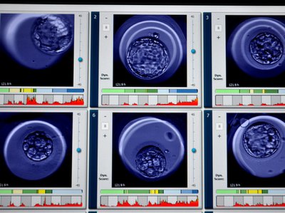 Brytyjczycy opracowali nową metodę selekcji embrionów IVF