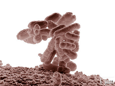 Przełom w walce z bakterią E. coli