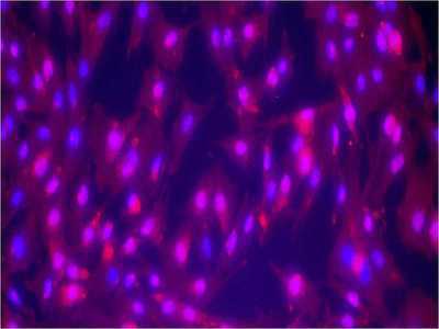 Komórki macierzyste z moczu – łatwe do wyizolowania i przydatne w wielu terapiach