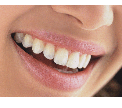 Jak dentyści odmładzają zęby?