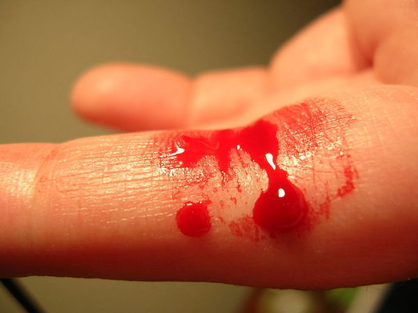 Krwawienia