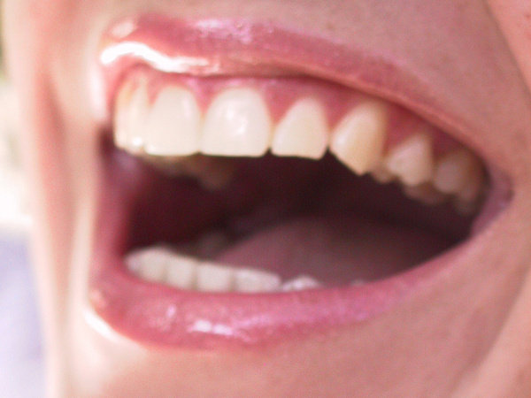 Co ma wspólnego dbanie o higienę jamy ustnej z wrzodami?