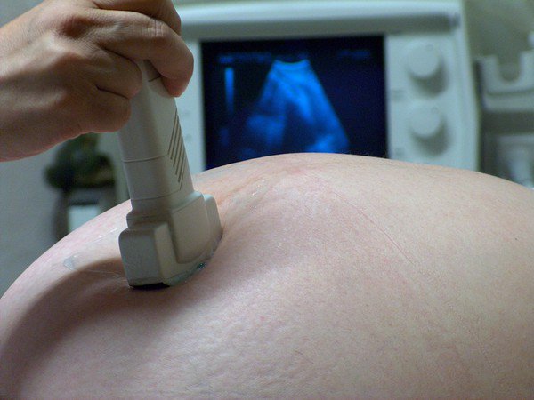 Dokonuj badania USG regularnie w czasie trwania ciąży!
